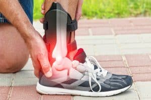 Plantar Fasciitis Treatment  Podiatrist, Foot Doctor Charleston, SC 29407  and Mount Pleasant, SC 29464