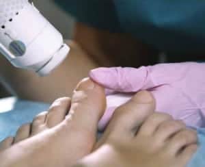 Cure for Toenail Fungus?