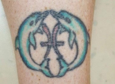 tattoo removal Pittsburgh