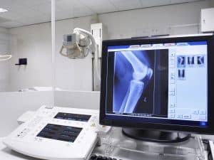 rayos diagnostics knie meniscus podiatrist radiology rand musculoskeletal economic