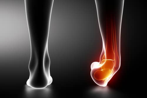 The Chronic Sprained Ankle That Won't Heal - In Touch