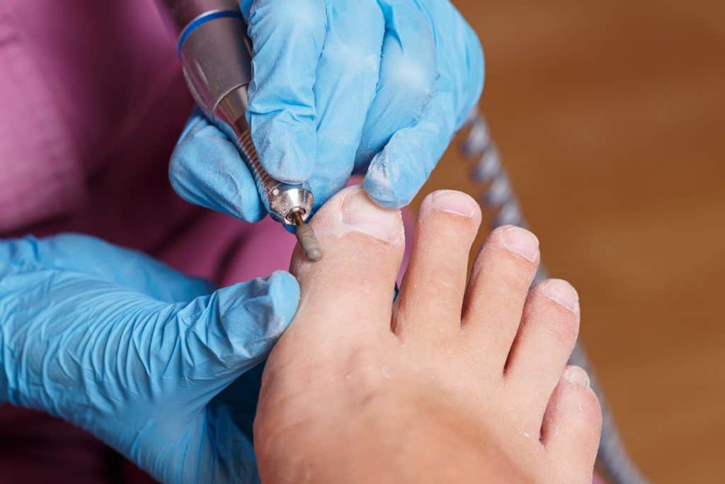 What are the main causes of ingrown toenails? - Beaver Valley Foot