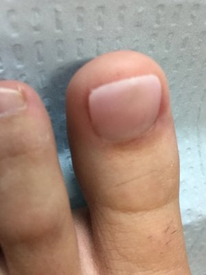 Natural Toes on X: Big toe closeup and natural toenails