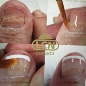 Cosmetic Toenails Pittsburgh