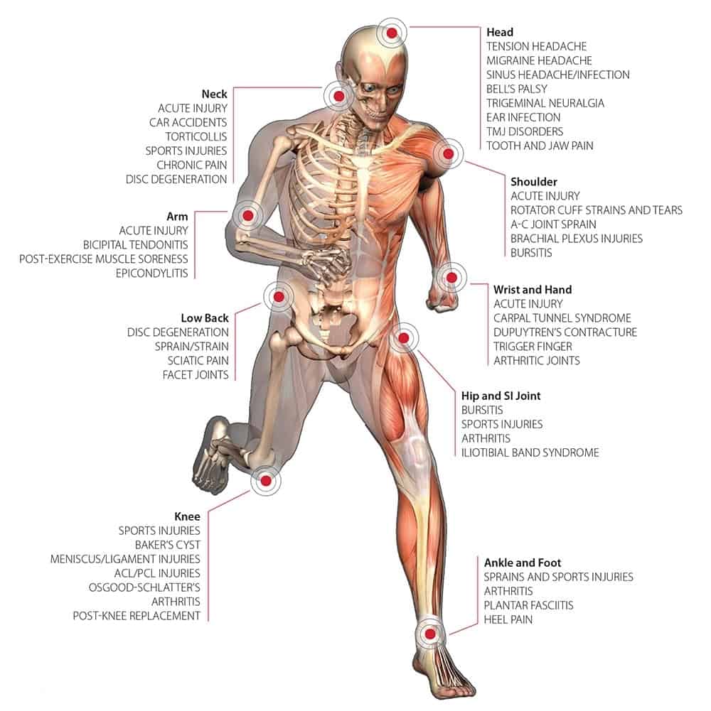 plantar fasciitis laser treatment near me