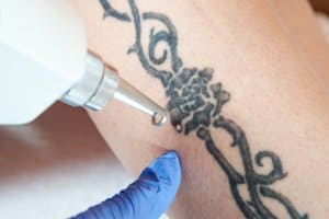 Tattoos and Arthritis: Safety Tips, Avoiding Infection, and More