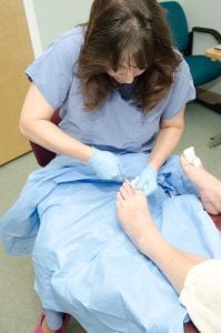 hammertoe treatment near me