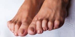 Crooked Toes and What Can I Do About Them - Podiatrist Near Me ...