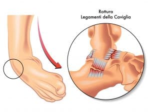 Hyaluronic Acid for ligaments