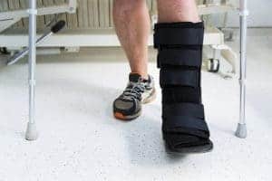 broken ankle treatment