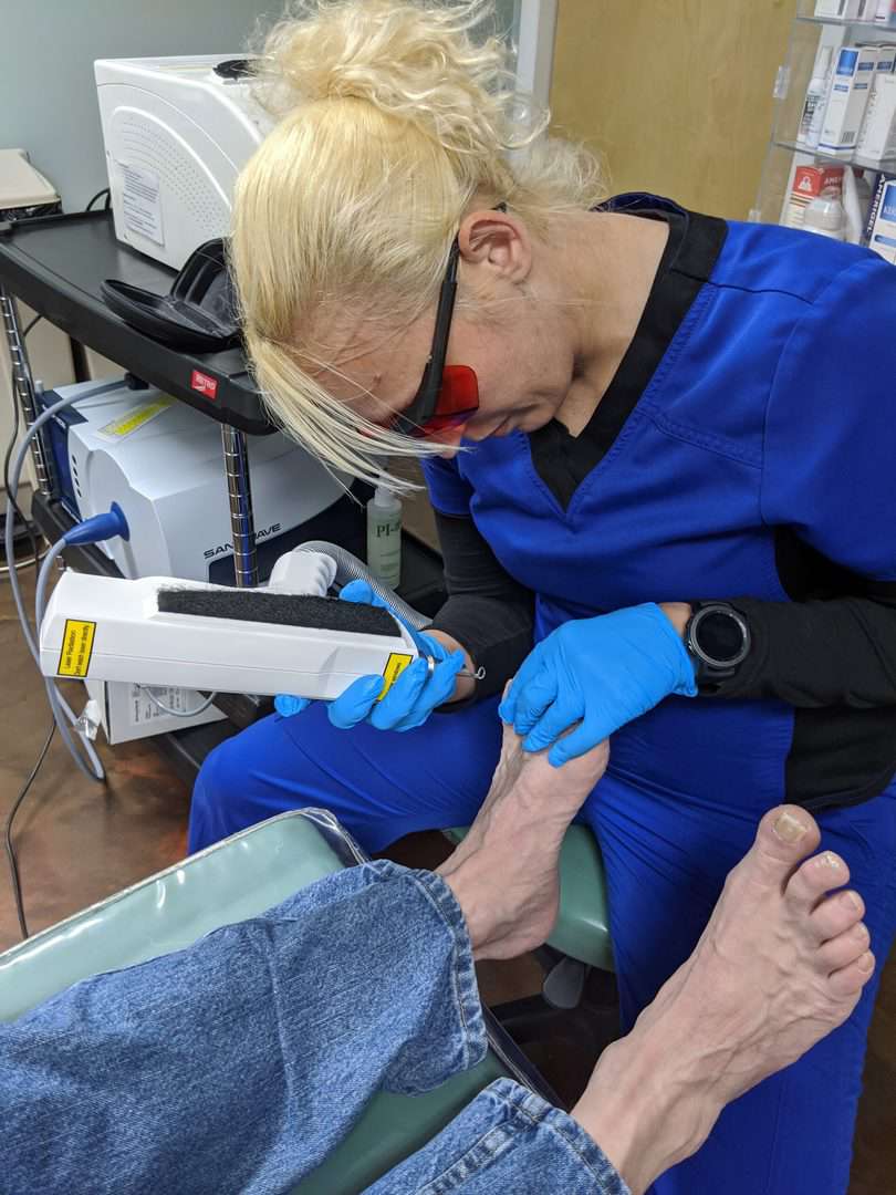 Toenail Fungus Treatment Laser Beaver Valley Foot Clinic