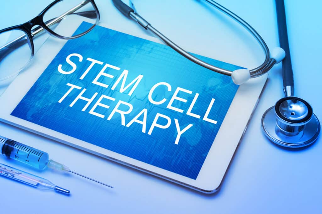 PLANTAR FASCIITIS – TREATMENT OPTIONS AND THE ROLE OF STEM CELL THERAPY