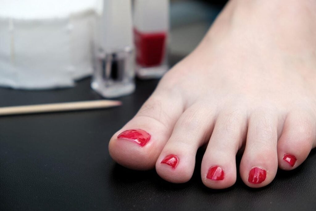 What Are The Best Toenail Fungus Treatments? - Scripps Health